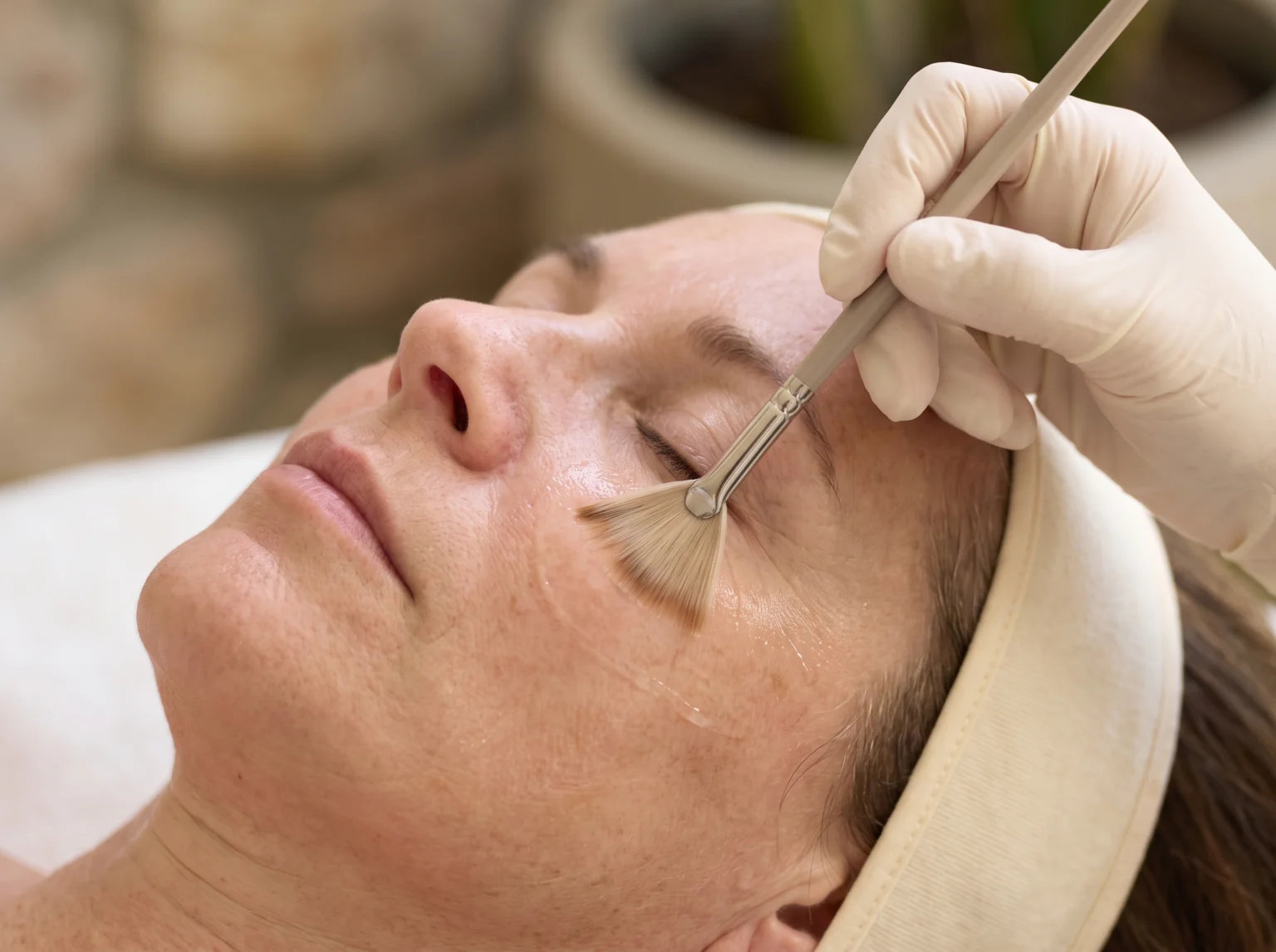 Chemical Peel Treatment consultation at AETÉ Skin Ritual Marylebone