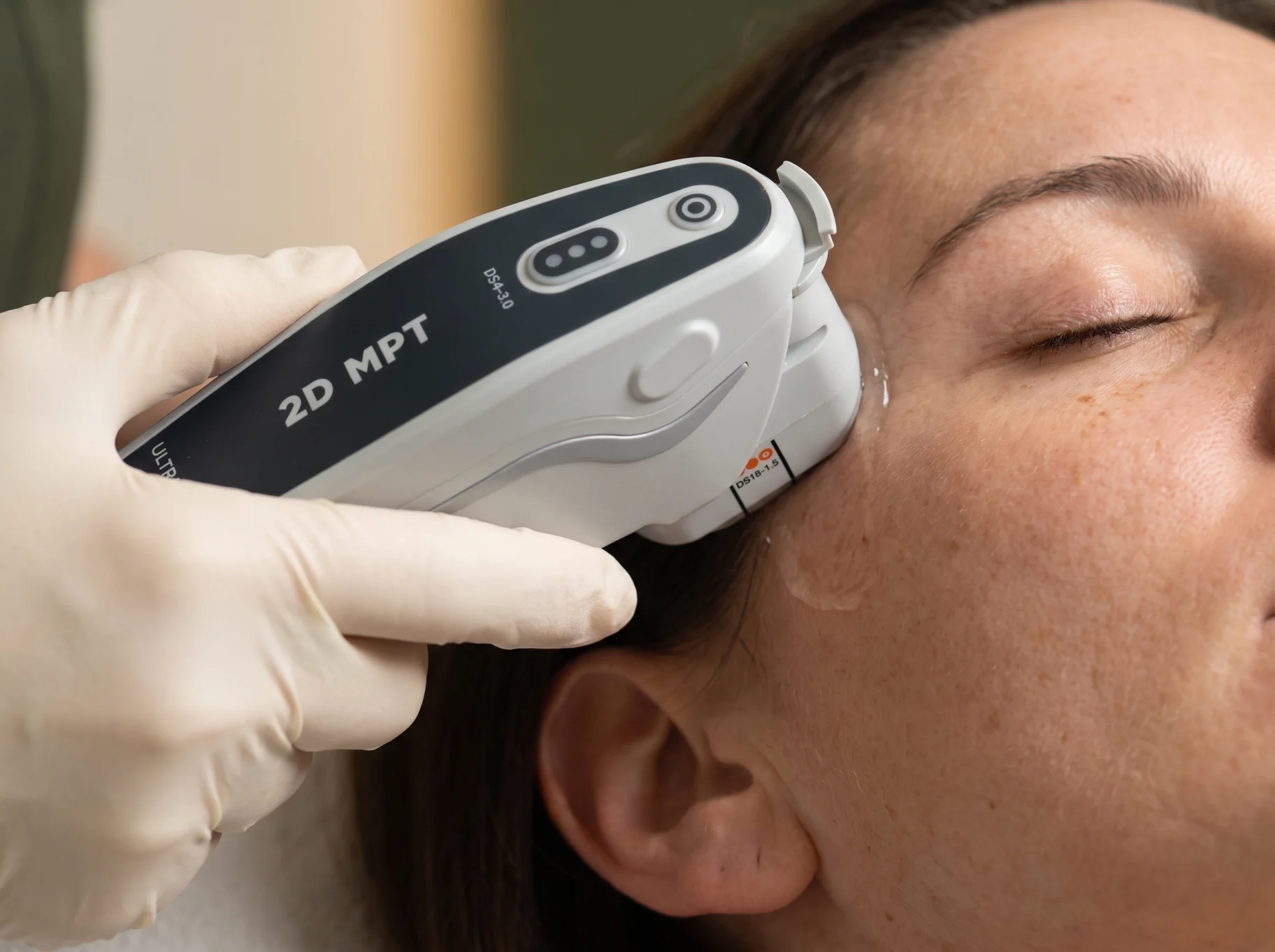 HIFU Treatment at AETÉ Skin Ritual in Marylebone London