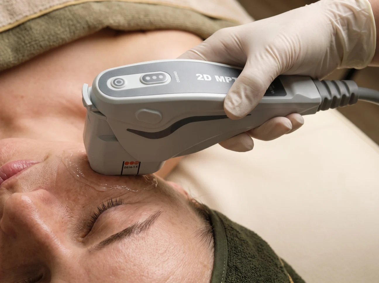 HIFU Treatment at AETÉ Skin Ritual in Marylebone London