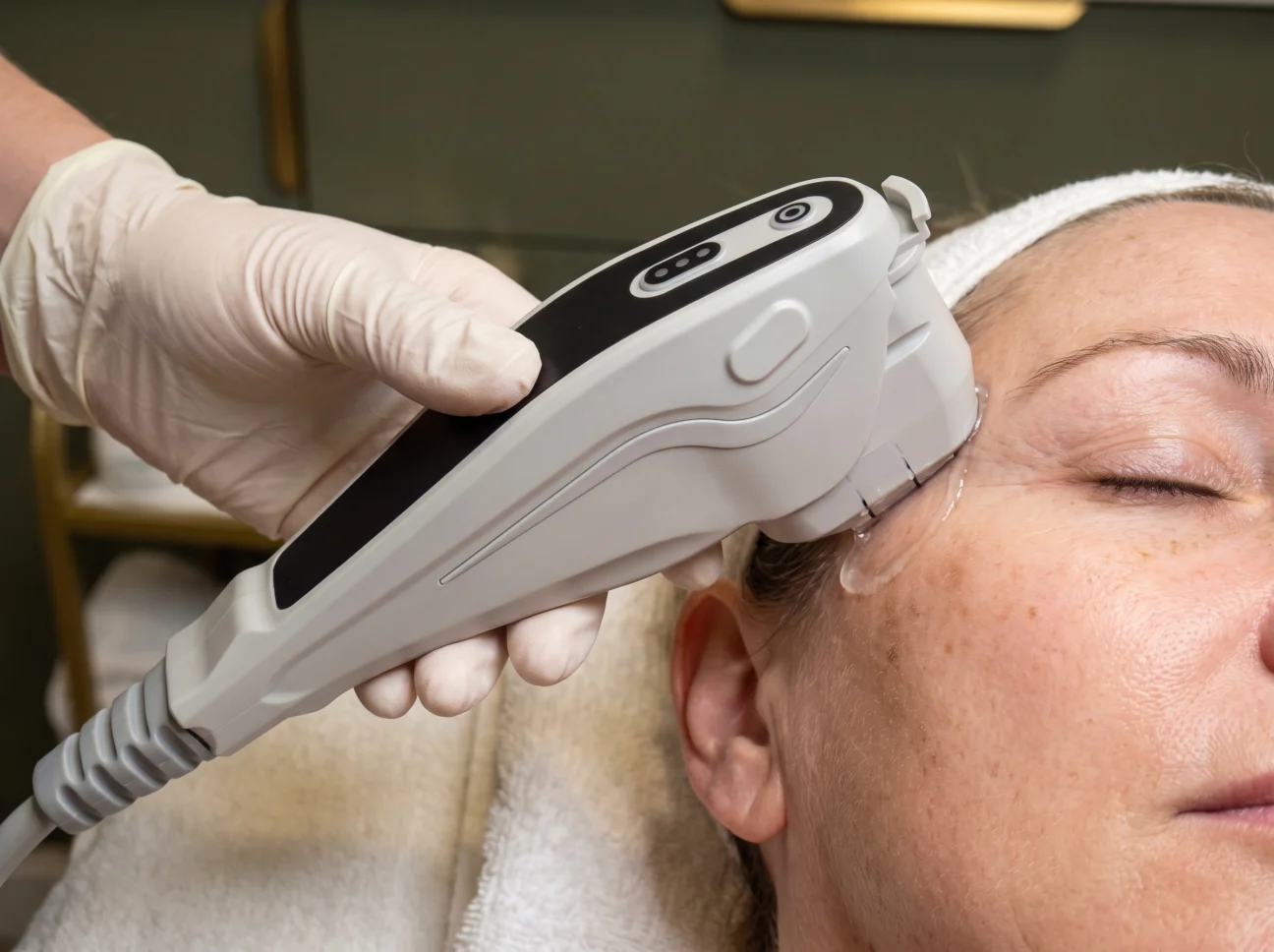 HIFU Treatment at AETÉ Skin Ritual in Marylebone London