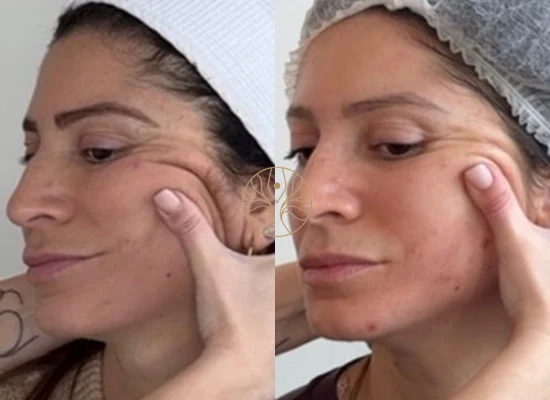 AETÉ Skin Ritual client result 12 in Marylebone