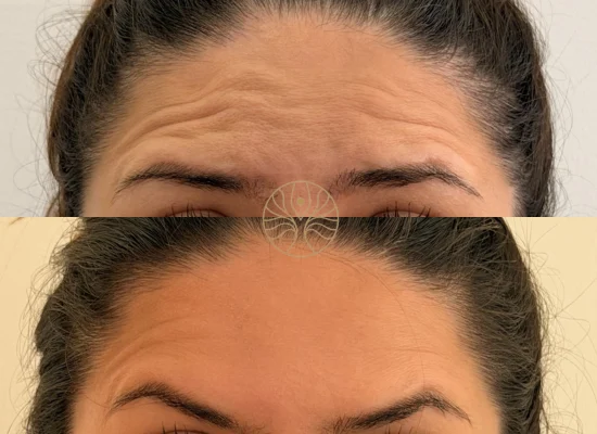 AETÉ Skin Ritual client result 8 in Marylebone