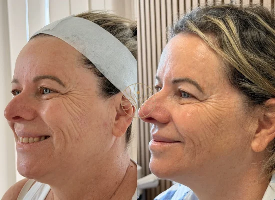 AETÉ Skin Ritual client result 3 in Marylebone