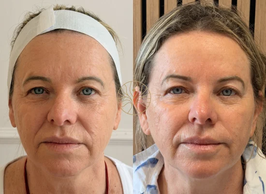 AETÉ Skin Ritual client result 7 in Marylebone