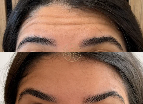 AETÉ Skin Ritual before and after result in Marylebone