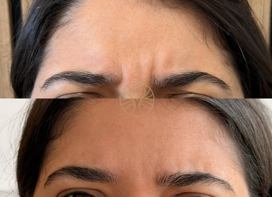 AETÉ Skin Ritual client result 5 in Marylebone