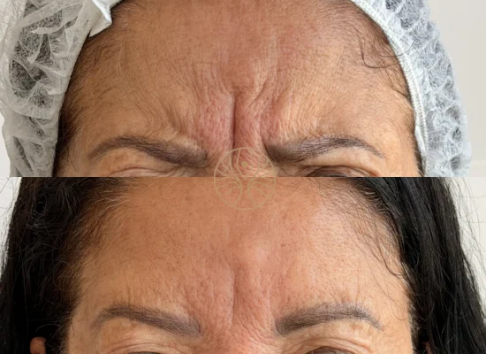 AETÉ Skin Ritual client result 4 in Marylebone