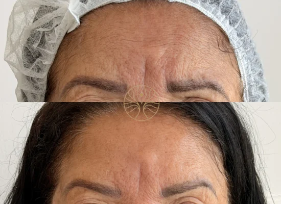 AETÉ Skin Ritual client result 6 in Marylebone