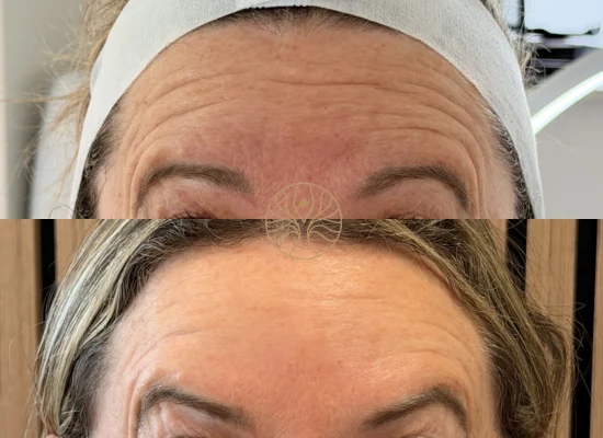 Real AETÉ Skin Ritual before and after client result in Marylebone
