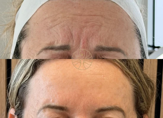 AETÉ Skin Ritual client result 9 in Marylebone